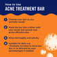 Panoxyl Acne Treatment Bar with 10% Benzoyl Peroxide - 4Oz: No Fragrance Added, Dye-Free, Vegan, for Acne-Prone Skin